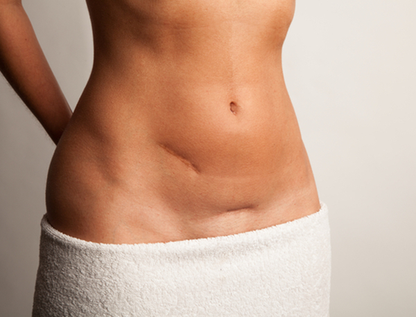 高龄女性如何做好卵巢保养,母亲最伟大能为孩子遮风挡雨