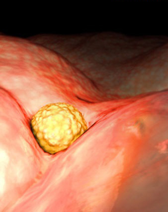 孕宝生长图,胎宝宝3d立体动画