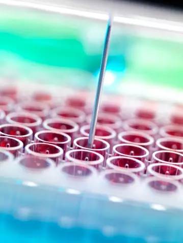 狼疮复发的11个征兆是啥,狼疮复发有哪些症状