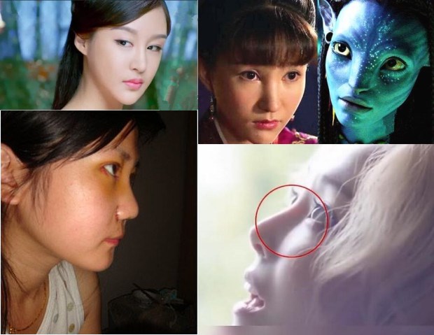 隆鼻手术后多长时间鼻头完全消肿,隆鼻手术失败了鼻头塌了怎么办