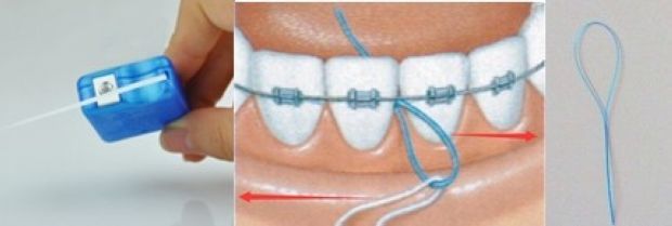 为什么两颗牙不能同时治疗,哪一颗牙最不容易发生蛀牙