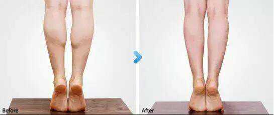 别不信！小腿就是这样被你一步步“撑粗”的