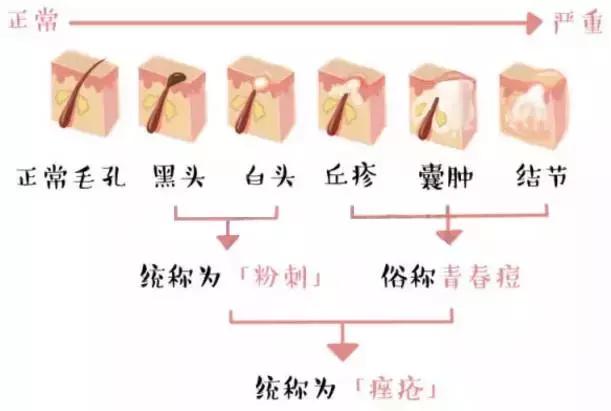 祛痘痘的正确护肤方法,长痘祛痘用什么方法最有效
