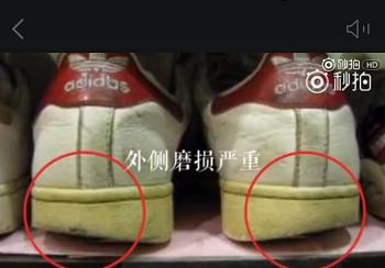 小腿外翻拉伸正确动作,小腿外翻能通过动作矫正吗