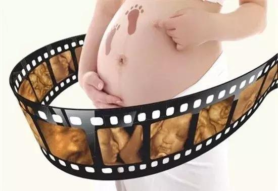 孕期四维彩超多高清,关于孕期超声检查你知道多少