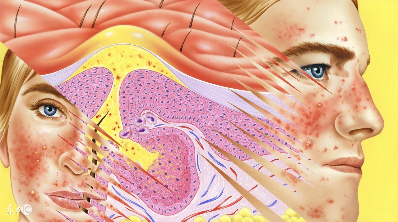 疮疡疾病的诊疗流程图,各种疮疡的鉴别