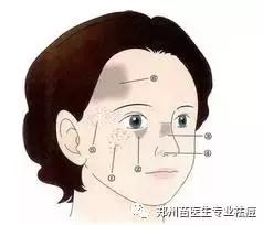 真皮斑会癌变吗,黄褐斑到底是真皮斑还是表皮斑