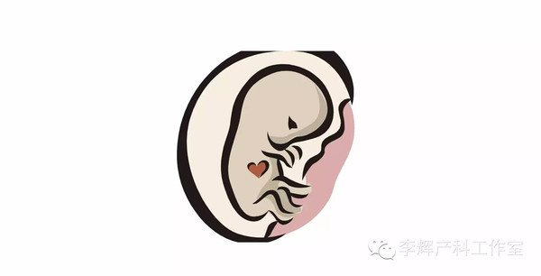 产科医生如何判断羊水情况,产科医生谈羊水栓塞