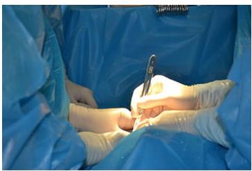 浅谈十大“隐形杀手伤害子宫”需让男人知道