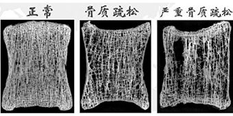 梅艳芳和阿桑，如果再有一次机会我一定会尽早离开“它”