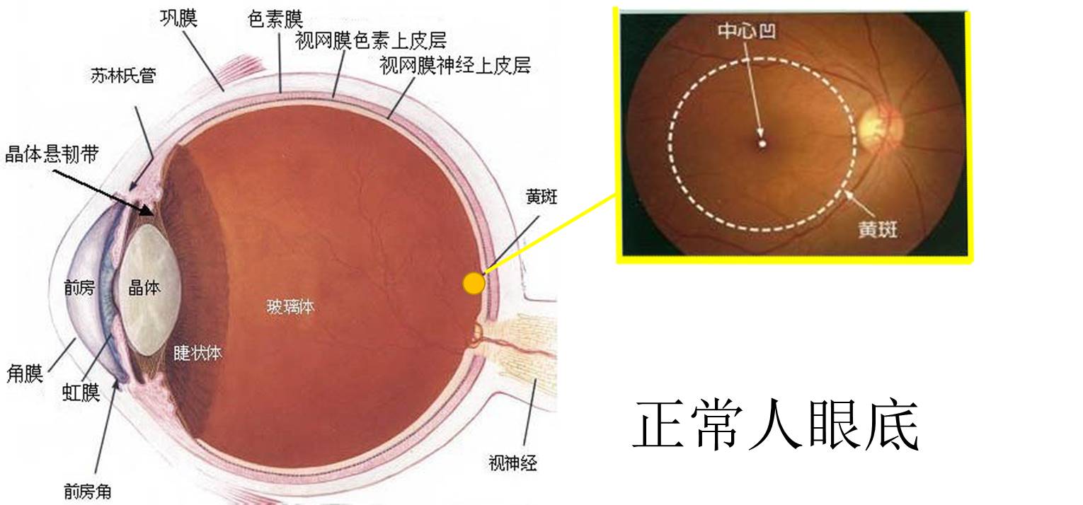 得了黄斑病变还能玩手机,得了黄斑病症状