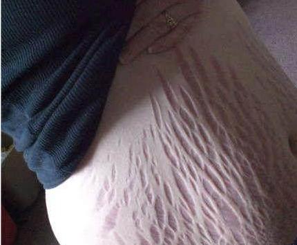 怀孕第十二周症状,怀孕第十七天的反应