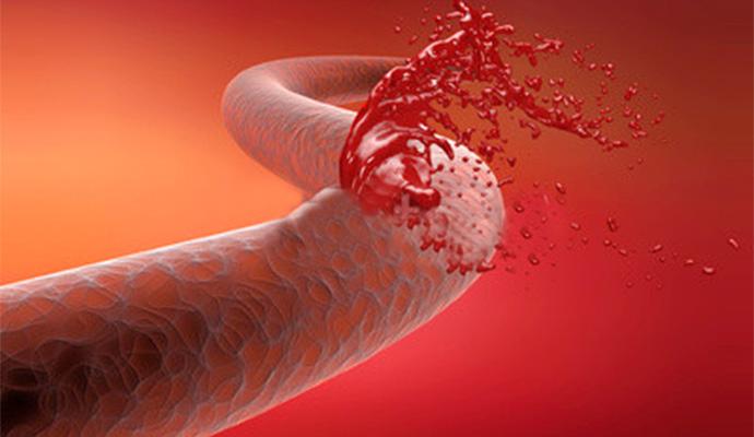 最近便后滴血是怎么回事,便后出血用什么药膏