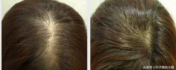 泰国值得代购的商品有哪些,泰国代购必买品