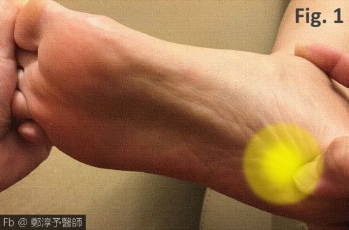 对付脚跟脚底痛！医师5招缓痛消肿，80%人都有效