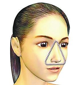 挤痘痘真的会引发败血症,挤痘痘的危害引发的肌肤问题