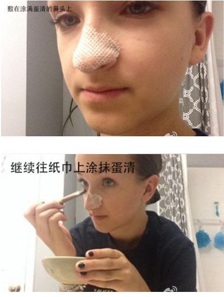 什么泥膜去黑头收缩毛孔最好,男士面膜去黑头收缩毛孔痘印