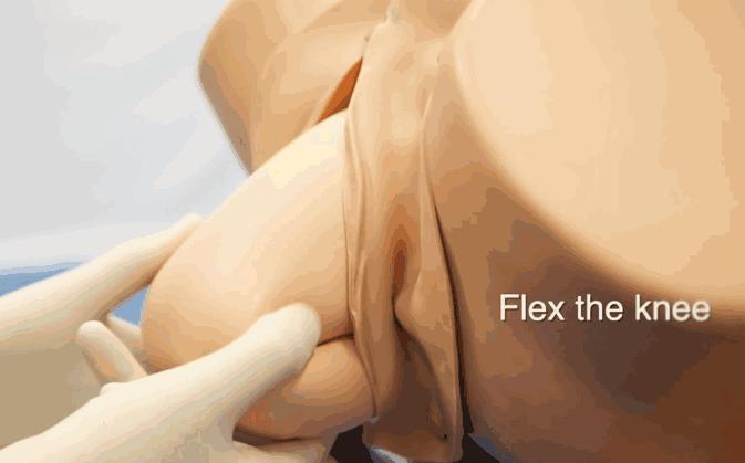 胎儿臀位出生视频,孕晚期胎儿臀位纠正视频