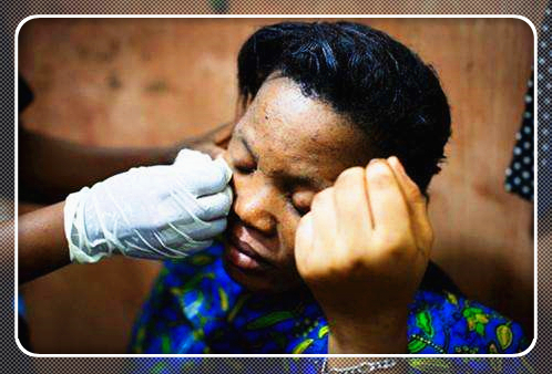 这种方法比整容还猛，非洲黑人女孩流行把全身肌肤漂白！