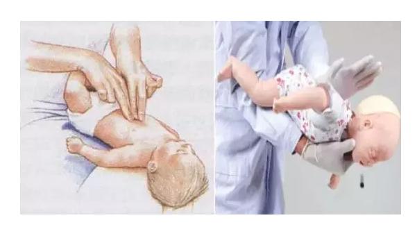 异物卡喉的急救方法婴儿,孕妇异物卡喉窒息时该怎么急救