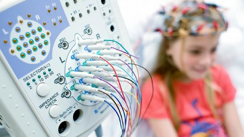 癫痫的常见五大误区,儿童良性癫痫常识和治疗方法