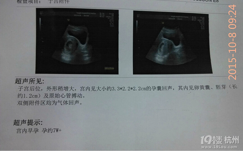 如愿生了个女宝,如愿备孕成功的记录