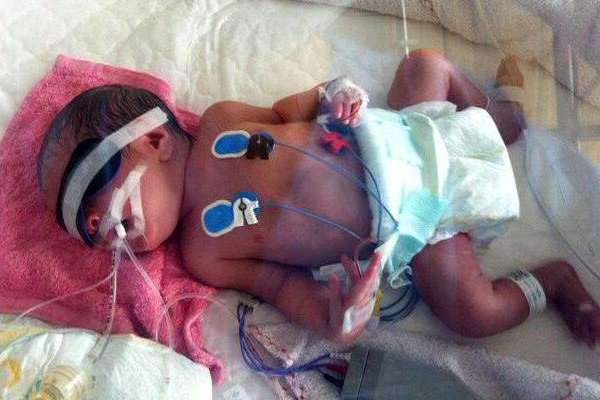 护士一时大意孕妇吃错药,护士疏忽婴儿死亡