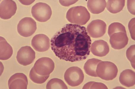 过敏性鼻炎的一般化治疗，光是确诊就需要这四个步骤，缺一不可！