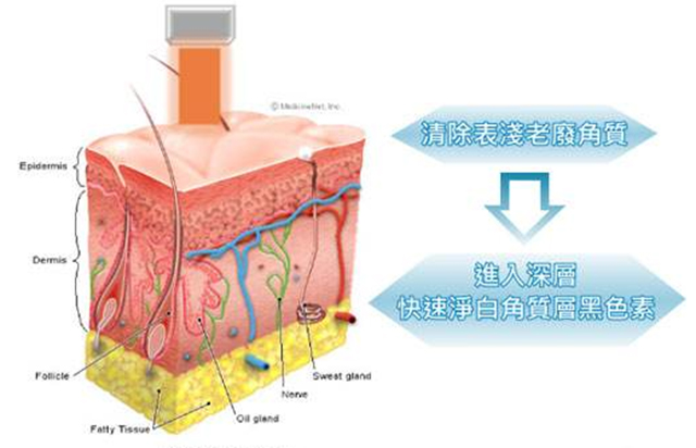 瓷娃娃美白过程,白瓷娃娃美白