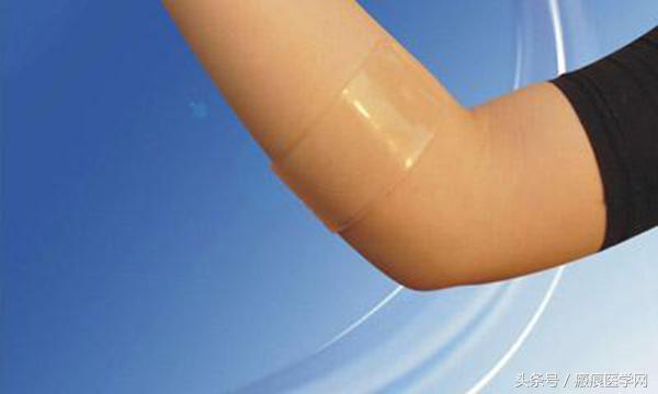 硅胶消除凹陷性疤痕,疤痕硅胶片的使用方法