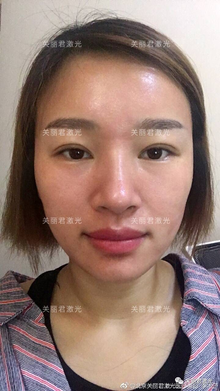 医学美白嫩肤方法,医生推荐的美白食疗方法