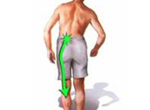 放射性痛是什么感觉,什么是放射性疼痛的症状