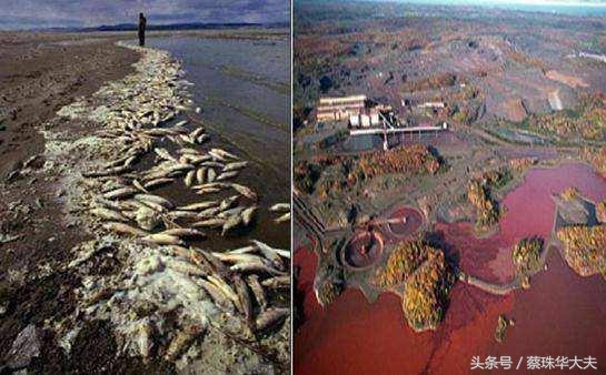 胎停流产后心理出现问题,胎停流产后抑郁怎么心理疏导