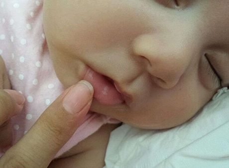 夏季小孩需要涂润唇膏吗,小孩用保湿唇膏