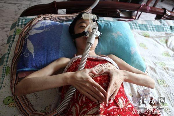 罕见病300万一年,300万一年的罕见病