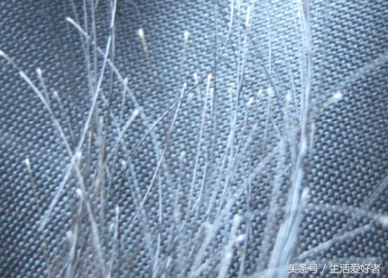 掉头发不长了怎么办,掉头发严重不长了怎么回事