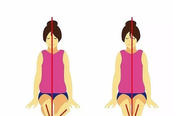 儿童骨盆倾斜长短腿调整方案,骨盆倾斜锻炼方法