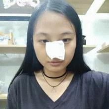 黑头去不掉需要去医院看吗,黑头不去处理会消失吗