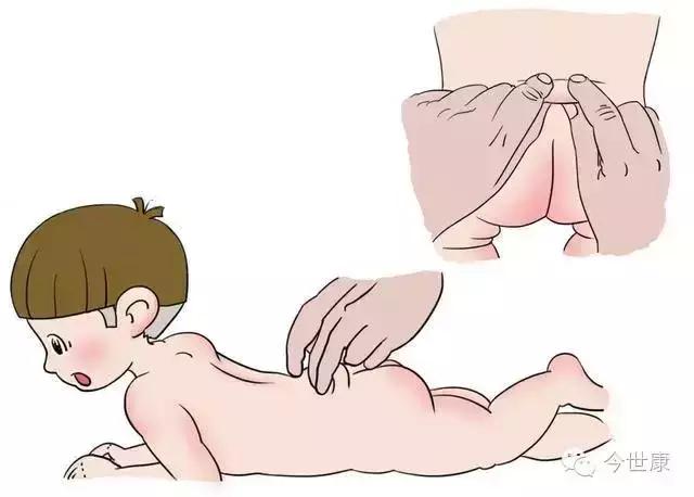 孩子捏脊的正确方法和好处,捏脊的好处小儿