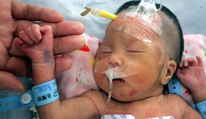 8个月宝宝第一次吃奶粉怎么给,七八个月宝宝辅食过敏怎么办