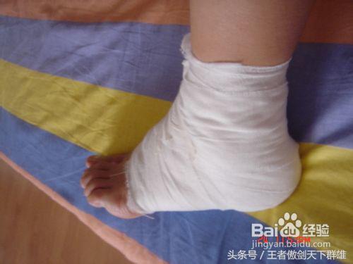 脖子崴了一下应该冰敷还是热敷,脚脖子崴了用啥药好止疼