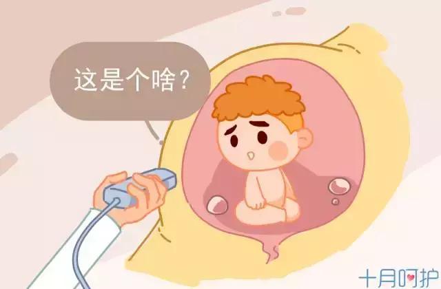 江门月子中心｜孕期腹痛不可轻视，小心是胎盘出了问题！