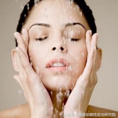 激素依赖性皮炎正确的护肤方法,激素依赖性皮炎爆发期怎么办