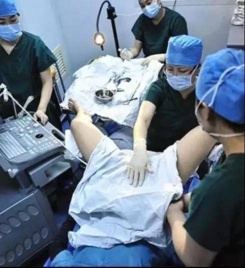 人工授精的原理是什么样的,人工授精由来