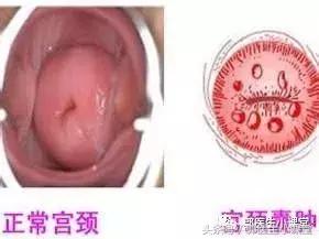妇产科医生告诉你，这个病其实不用治