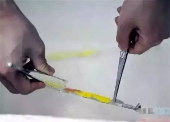 人工授精的原理是什么样的,人工授精由来