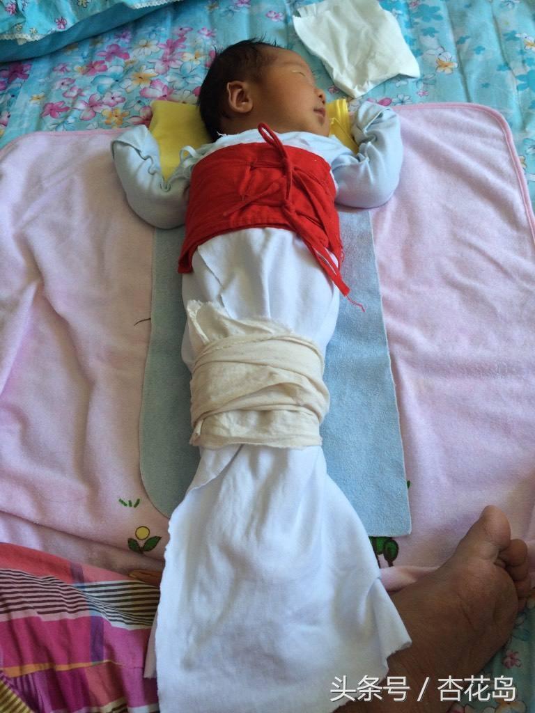 宝宝绑腿能矫正o型腿吗,宝宝o型腿能绑吗