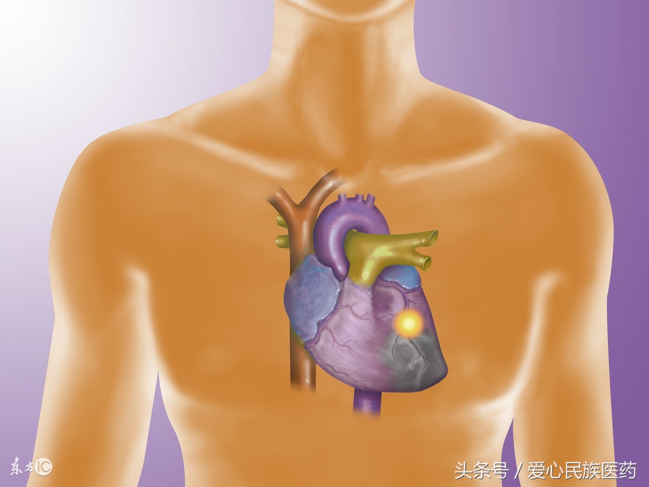 治疗冠心病中成药也是不错的选择
