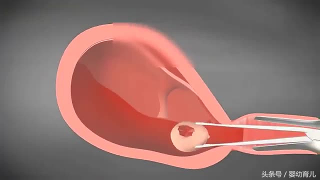 人工流产的胎儿会变成什么样,人工流产的胎儿在肚子里什么样