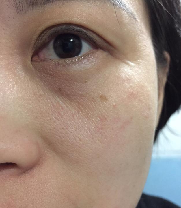 朵嘉浓敏感肌肤修复,朵嘉浓收缩毛孔